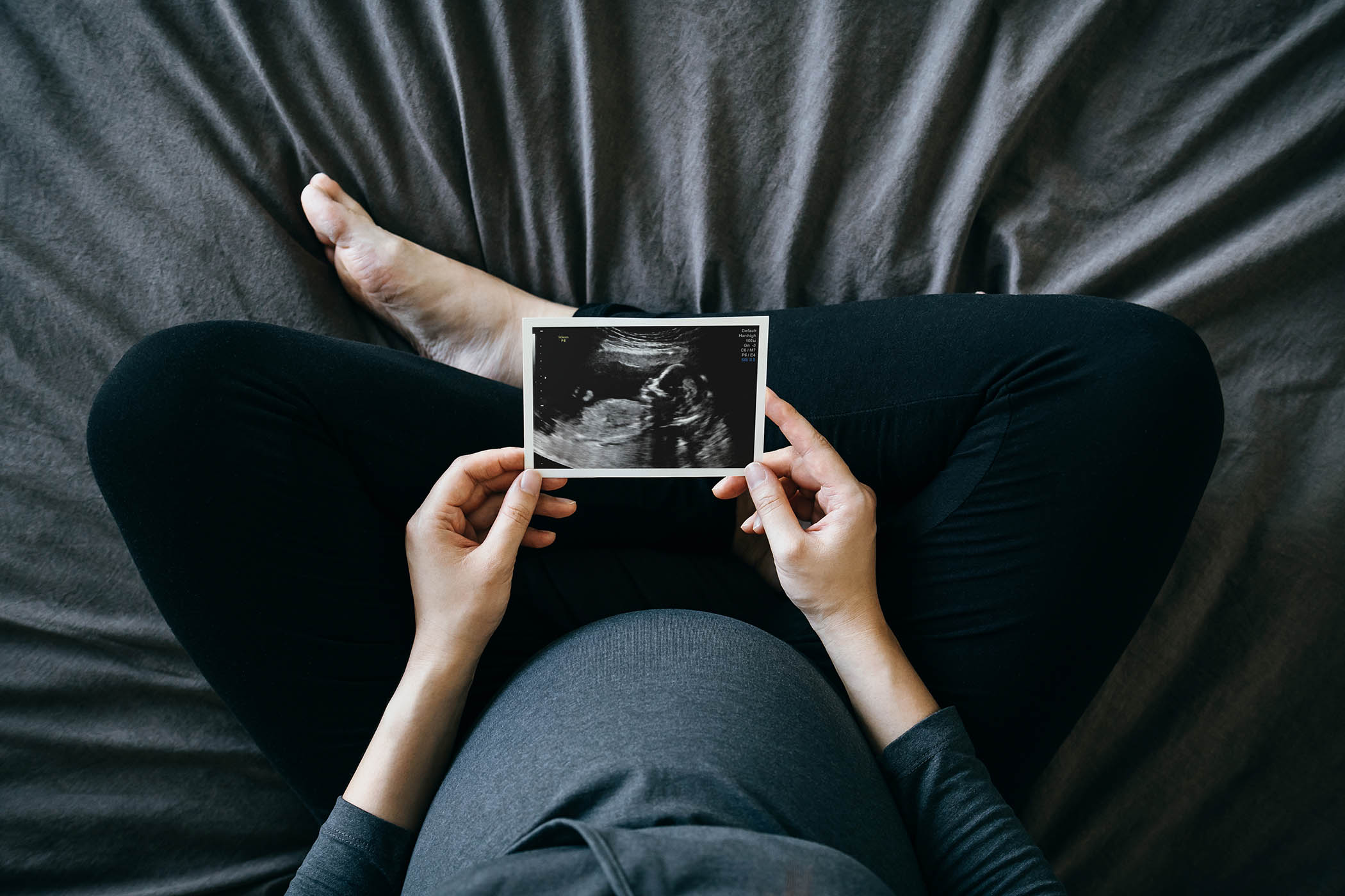 Businesses are losing millions by refusing fertility leave