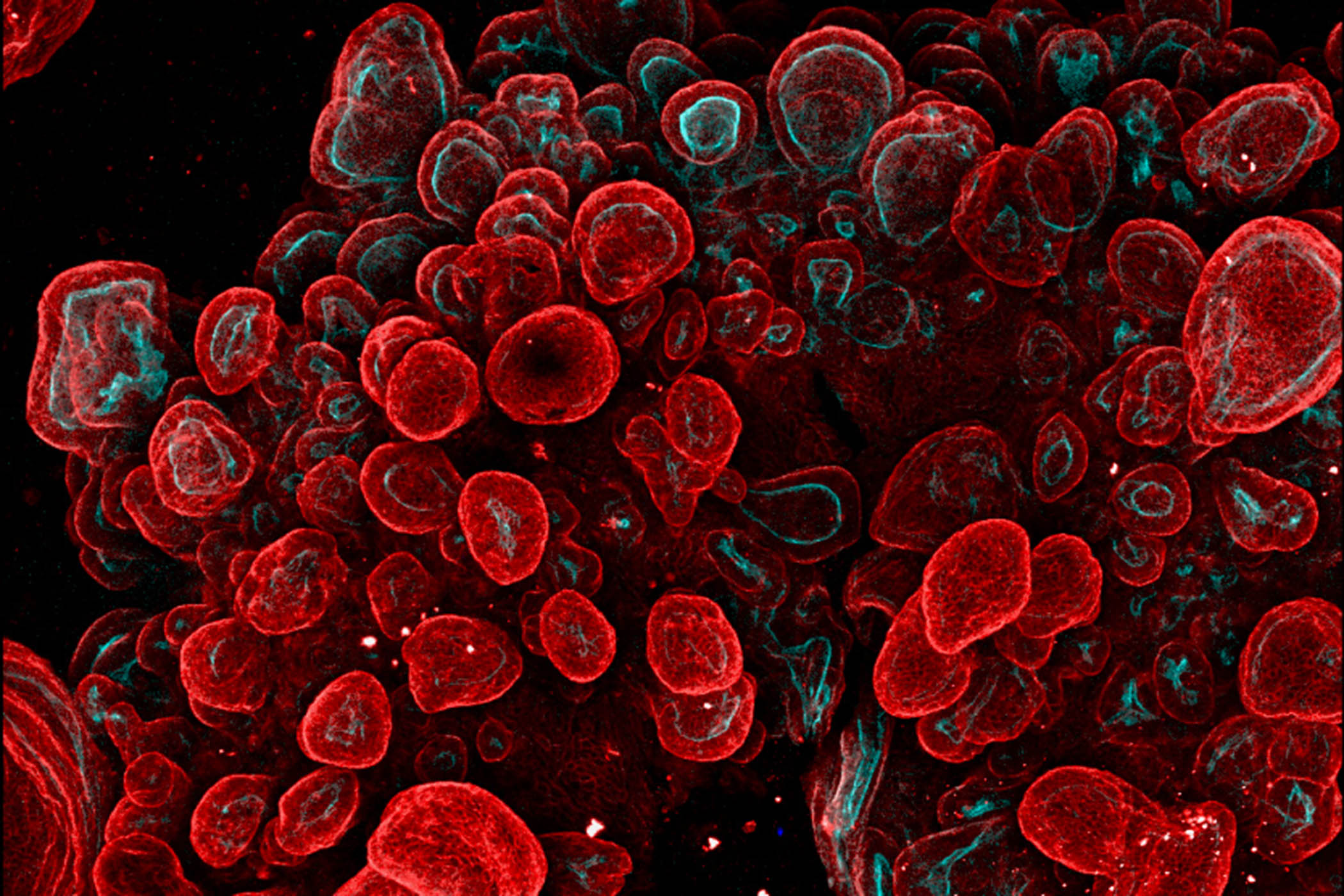 Scientists create mini-stomachs to test drugs